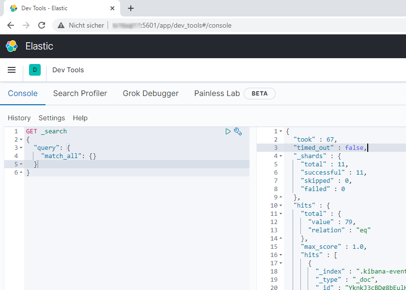 Chrome Kibana Management
