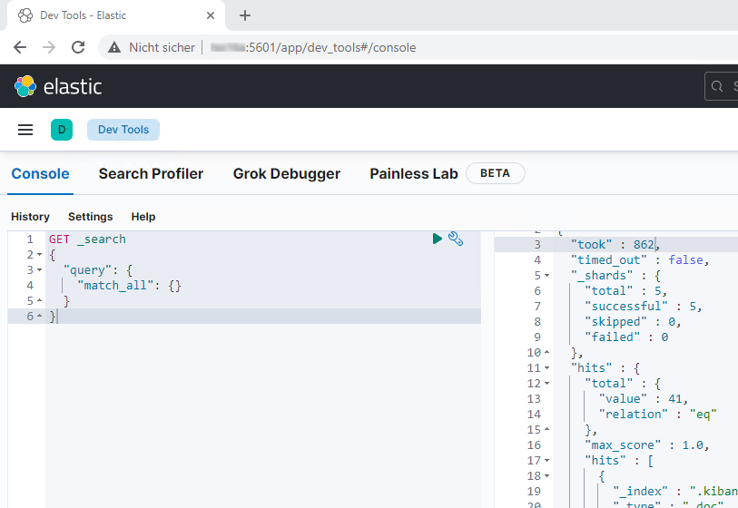 Chrome Kibana Management